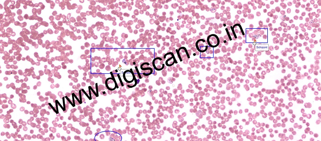 Hematology Digital Slides Set (Peripheral Blood Smear & Bone Marrow Slides)